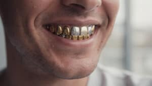 découvrez pourquoi choisir des grillz en or ou en argent sur mesure garantit un ajustement parfait, un style unique et une qualité supérieure pour un sourire éclatant.